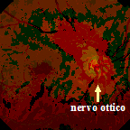 nervo