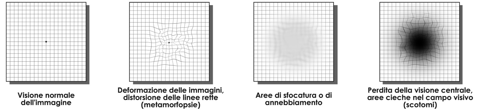 Griglia-di-Amsler