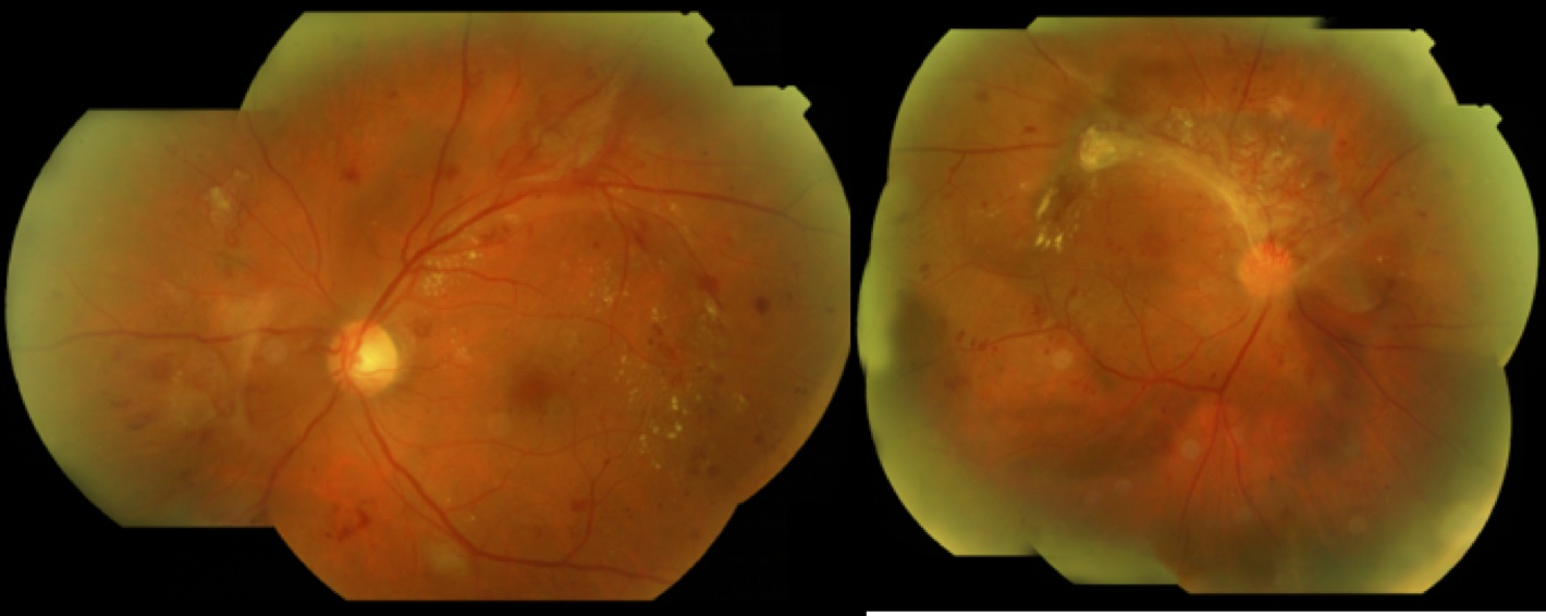 Fundus